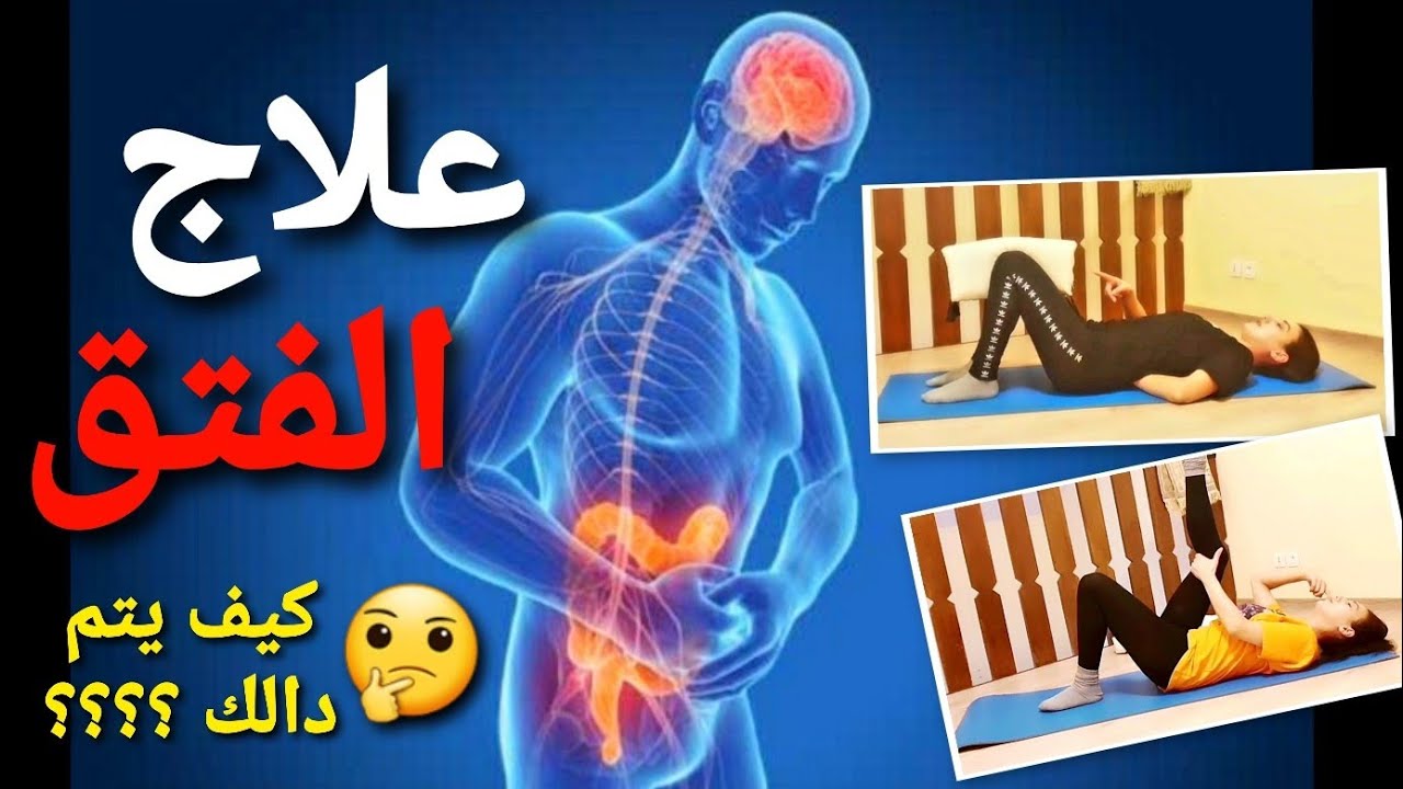 علاج الفتق 👈 ما الدي يحدت داخل جسمك ؟ و كيف يتم دالك ؟ #khtisara_channel #الفتق #العلاج #الطبيعي