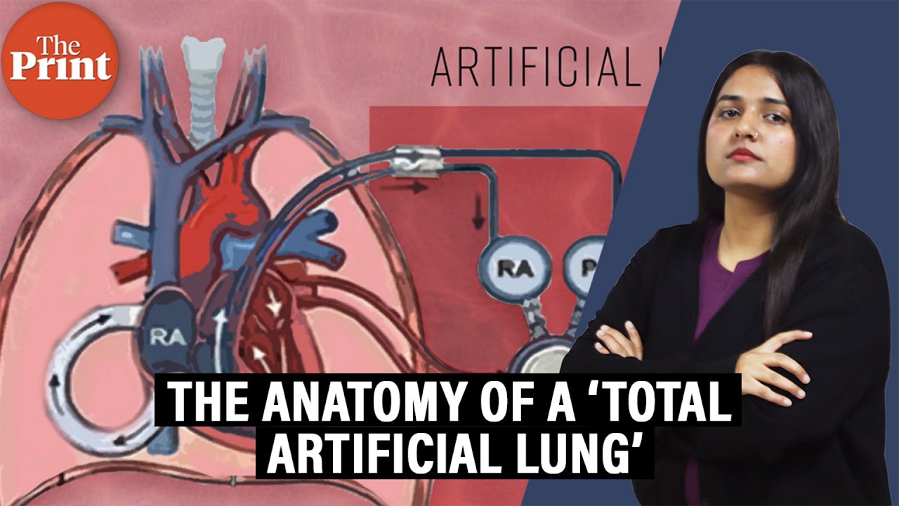A US man lived two days without lungs. Why doctors say it could change lung transplants