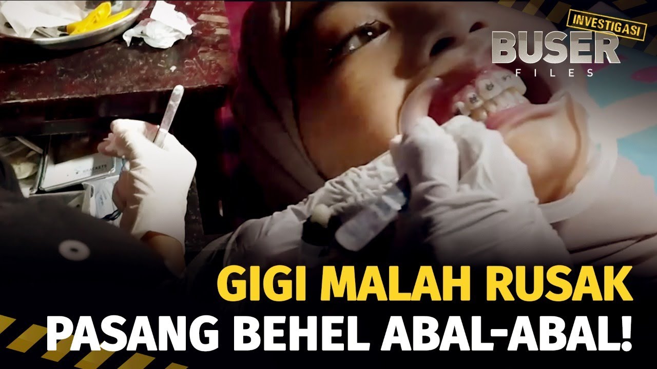 Bahaya di Balik Perawatan Kecantikan Gigi Tapi Instan | Buser Investigasi