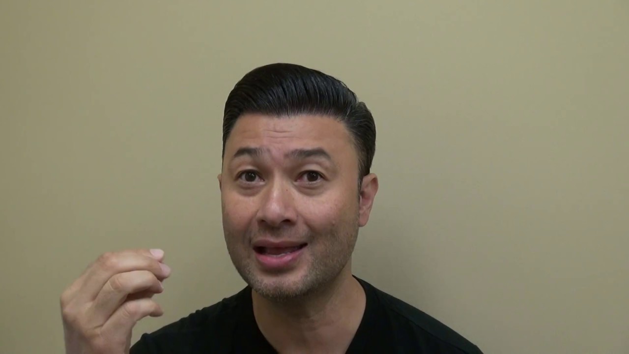 Hair Transplant 12 Month Follow Up Restoration Surgery Progress Dr. Diep 