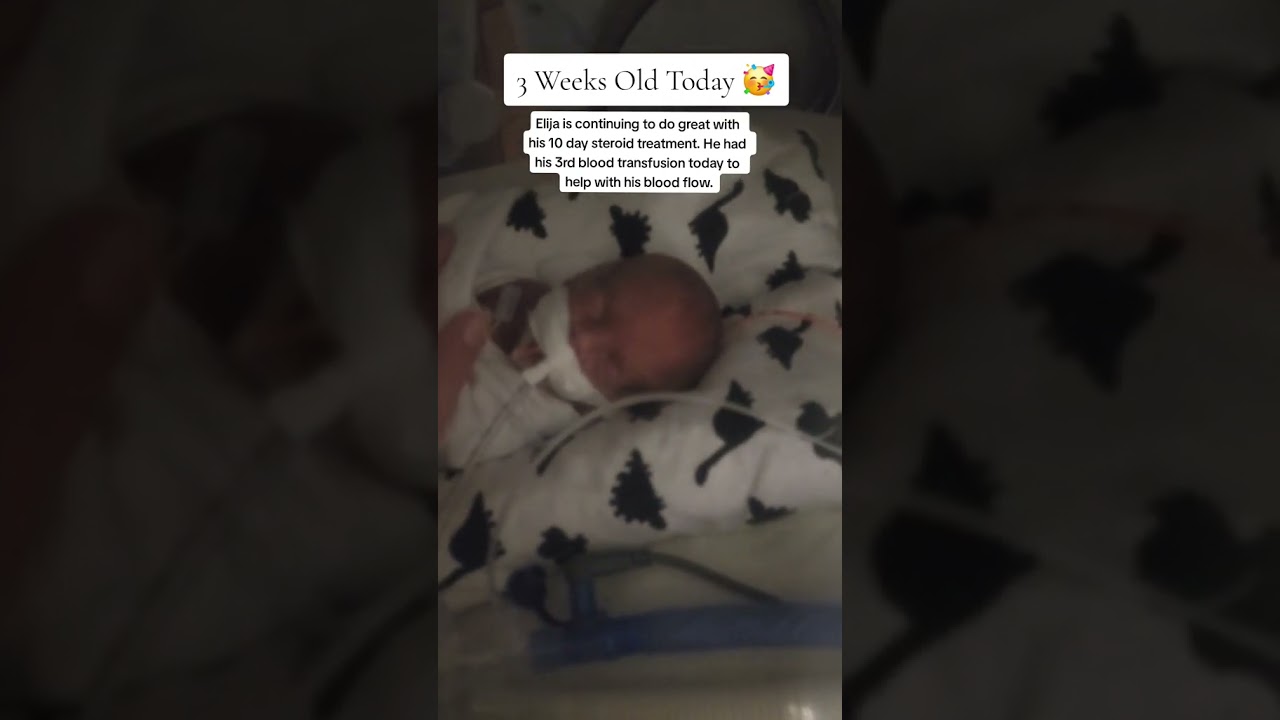 3 Week Old Micro Preemie Baby 