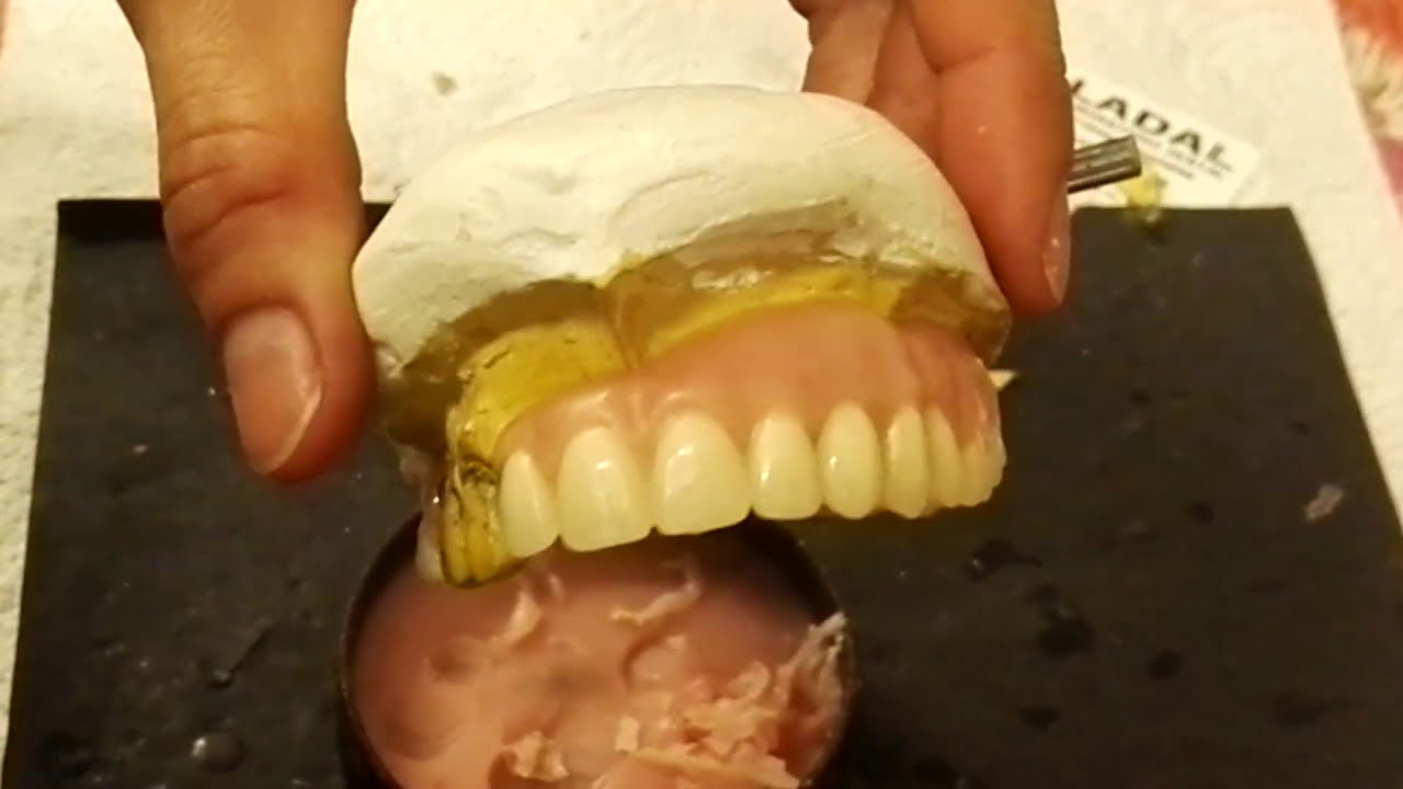 Como hacer la encía de una prótesis dental?