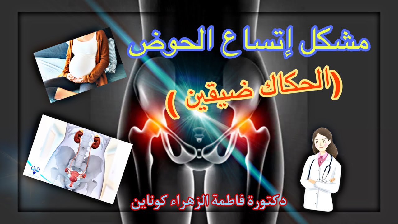 مشكل في اتساع الحوض او بالعامية ( الحكاك ضيفين)