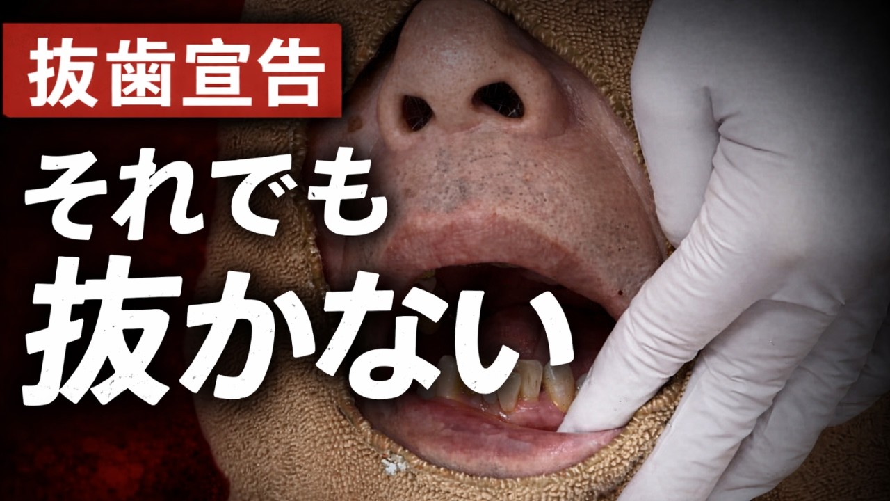 インプラント回避できるのか？重度歯周病のリアルな治療全記録