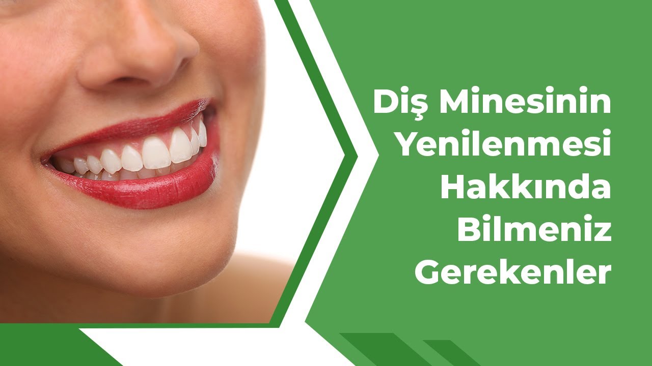 Diş Minesinin Yenilenmesi Hakkında Bilmeniz Gerekenler