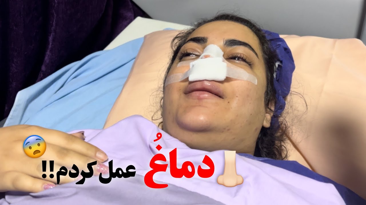 بالاخره دماغمو عمل كردم!!!🥲👃🏻😂🥹