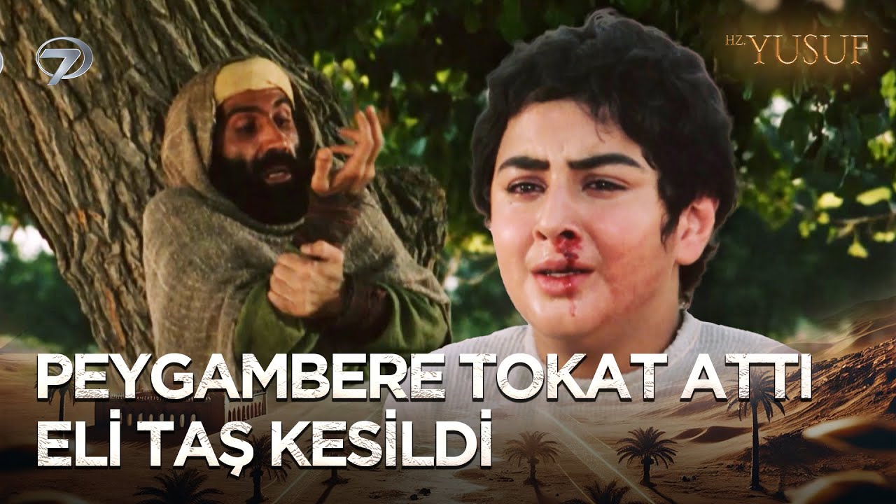 Hz. Yusuf, Kendini Döven Adamın Elini İyileştirdi | Hz. Yusuf