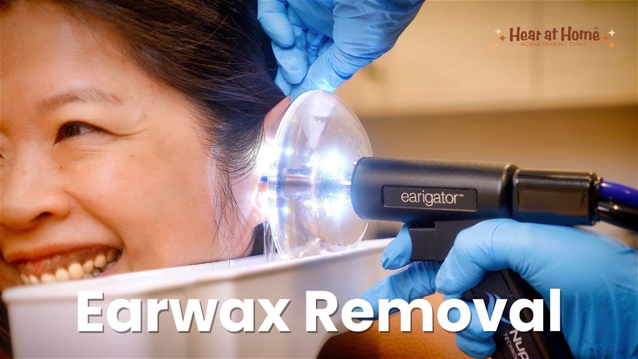 Earwax Removal with the Earigator at Hear at Home Hearing Clinic