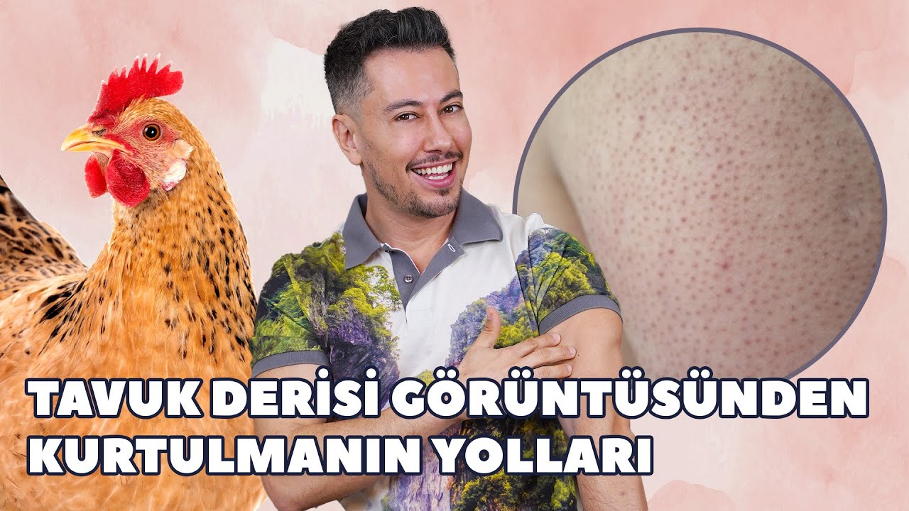 Tavuk Derisi Görüntüsünden Kurtulmanın Yolları 🐔 (Keratosis Pilaris)