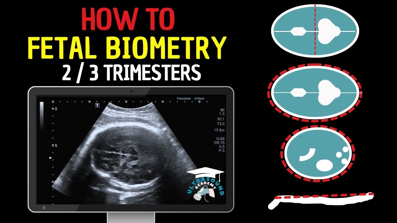 How to Perform Fetal Biometry in the Second and Third Trimesters | Practical Guide
