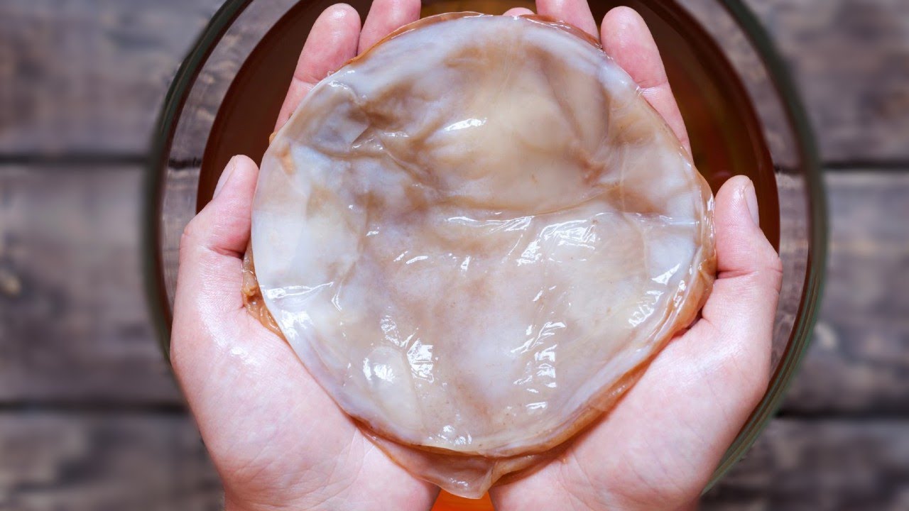 5 Gr&uuml;nde, warum Kombucha so gesund ist