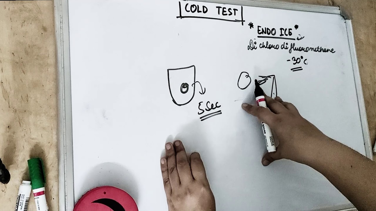 how reliable is cold test for pulp vitality?