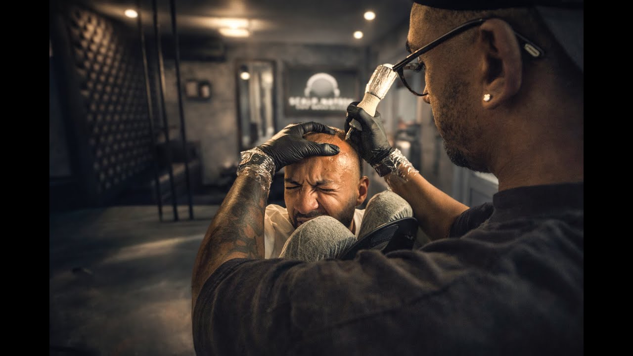Scalp Micropigmentation Uncovered