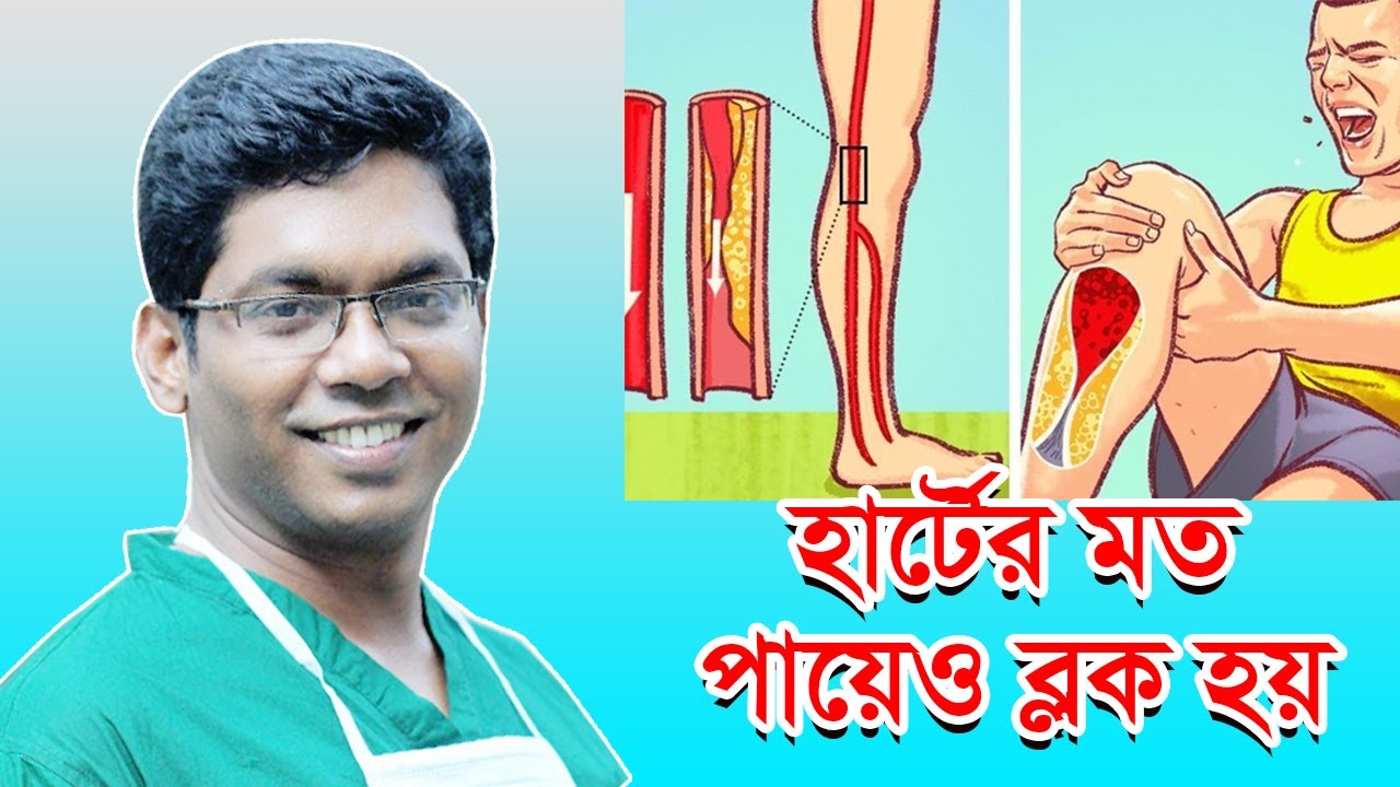 হার্টের মত পায়েও ব্লক হয়।  Dr.Saklayen Russel