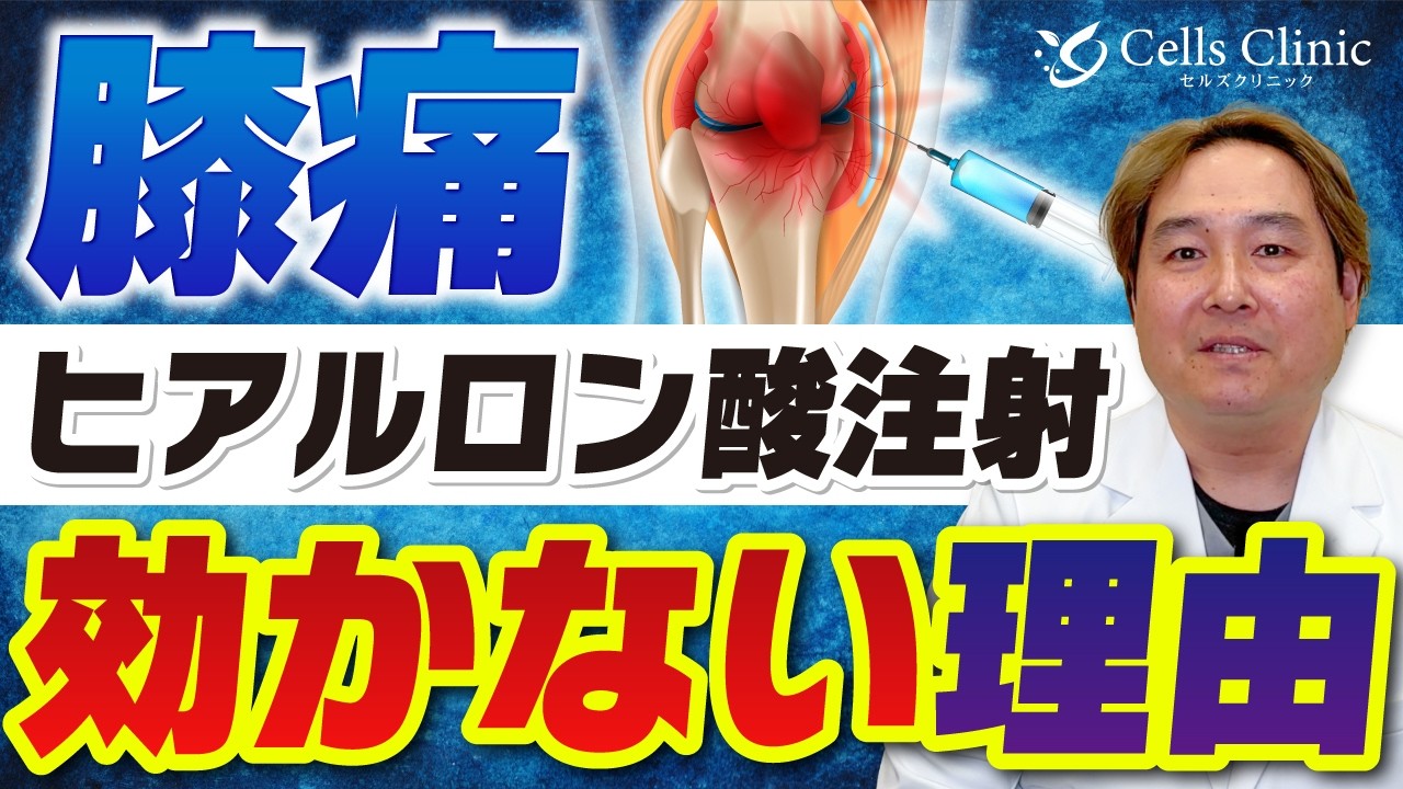 膝のヒアルロン酸注射の効果が切れる原因と治療の選び方｜整形外科医の判断基準
