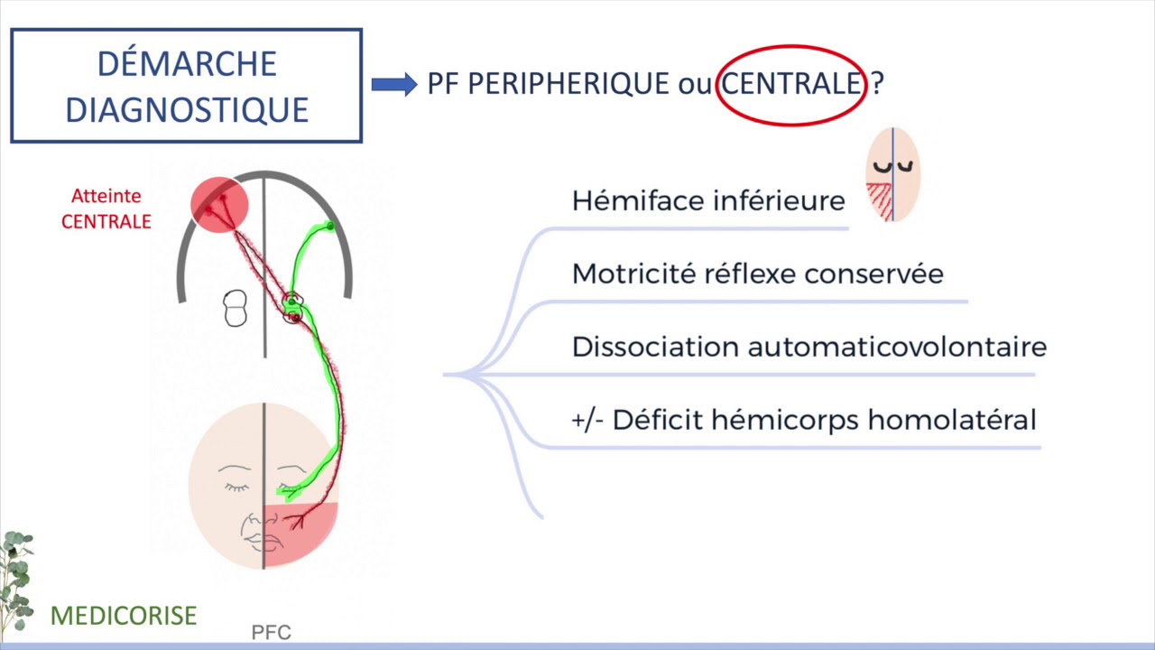 Nerf facial et paralysie faciale périphérique - ECN & FMC - Anatomie