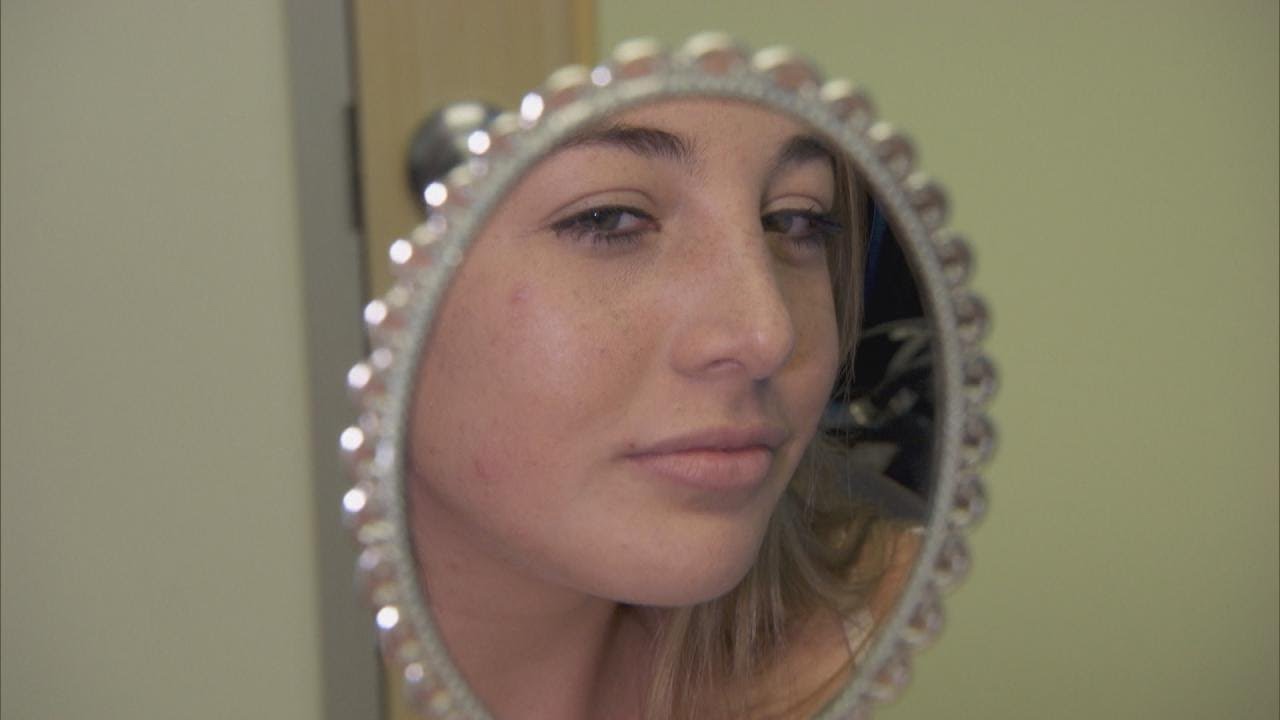 Why This California Teen Got a Nose Job for Start of School