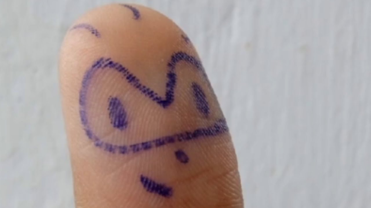 Thumb The Hedgefinger