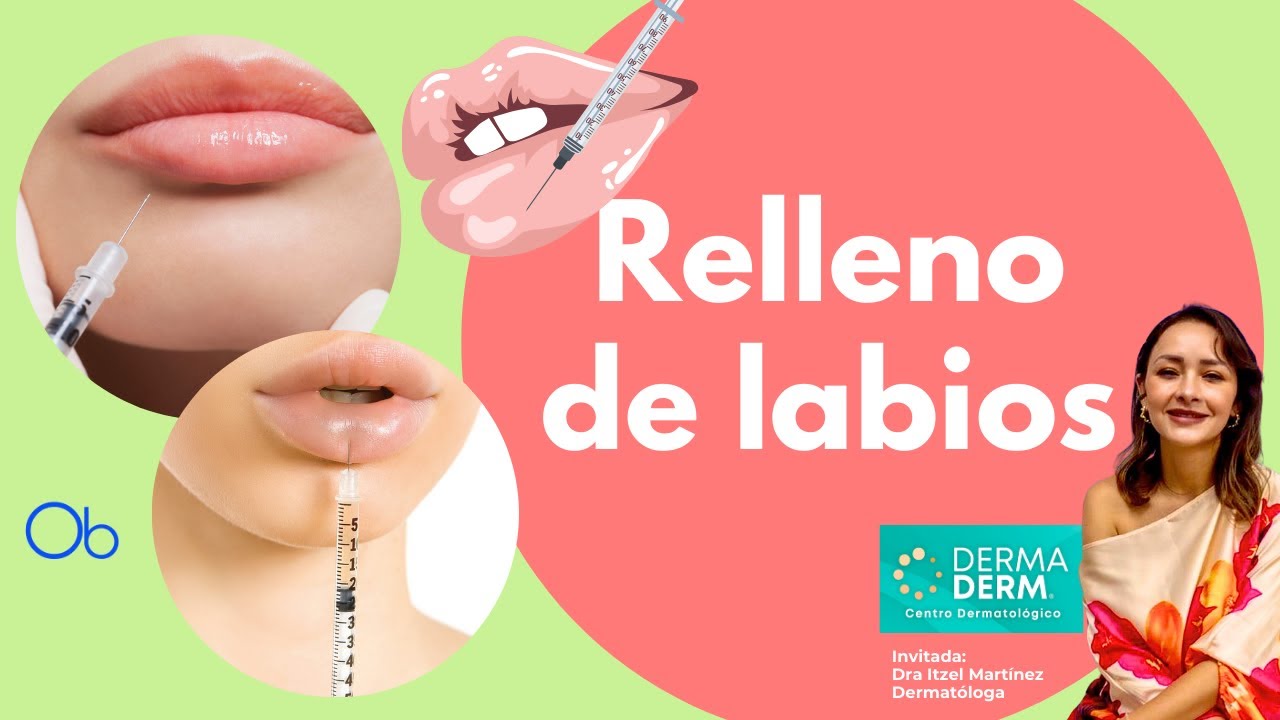 Todo sobre RELLENO DE LABIOS 👄 con la Dra Itzel Martínez - Dermatóloga