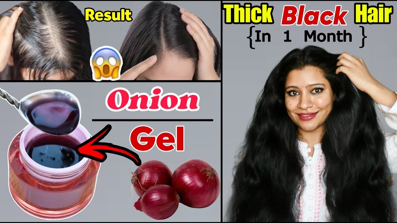 Overnight Gel To Make Hair Thick & Black Naturally बालों को घना, काला बनाने के लिए प्याज का जेल।