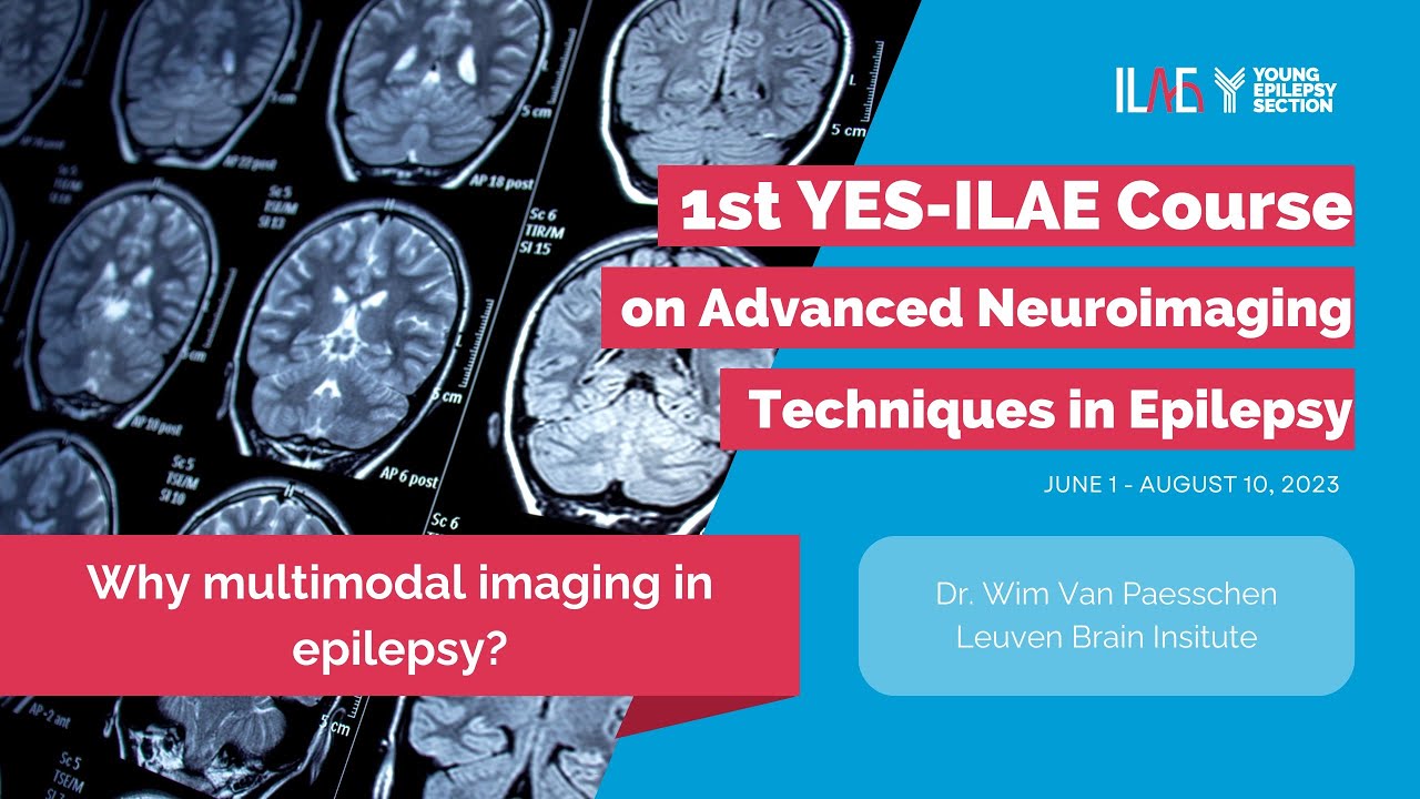 1st Lecture Multimodal Neuroimaging in Epilepsy
