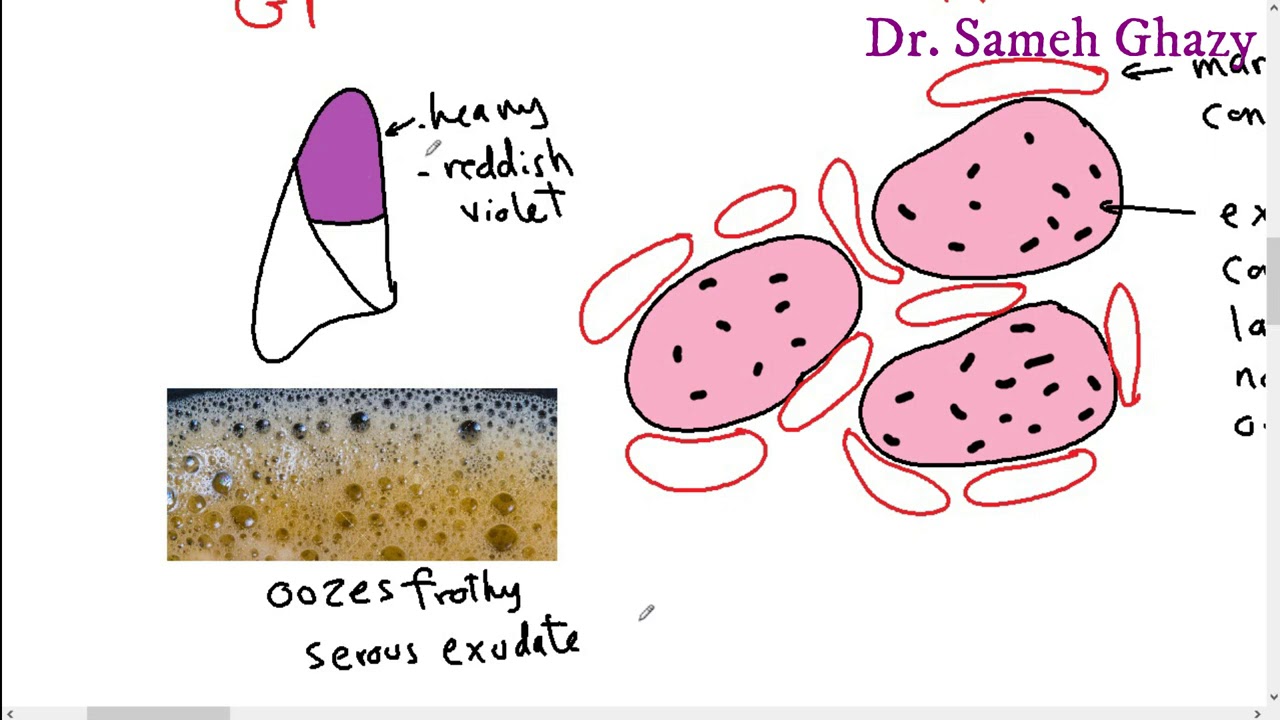 Systemic pathology 13 : respiratory system 1 ( pneumonia and lung abscess) DR.SAMEH GHAZY