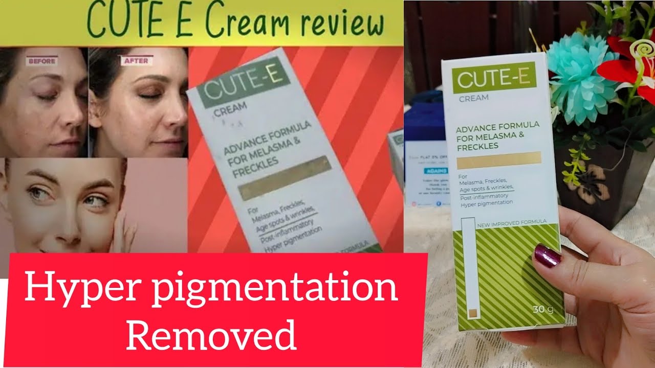 Wisdom Pharma Products|| Cute e Cream Review|| hyper pigmentation & Freckles removed