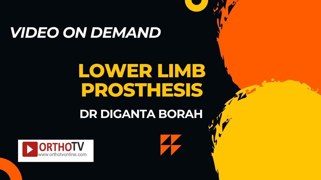 LOWER LIMB PROSTHESIS - Dr. Diganta Borah