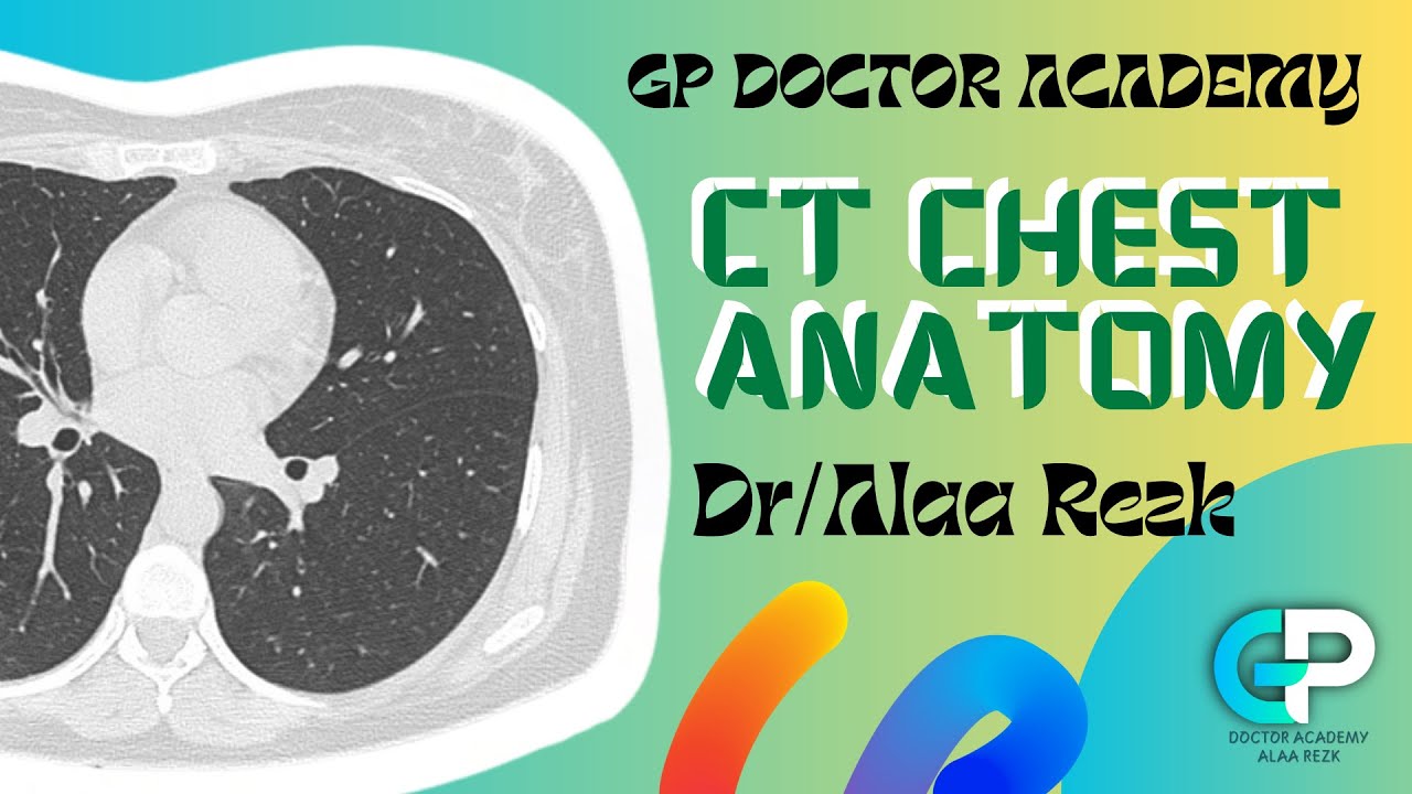 CT  chest Anatomy
