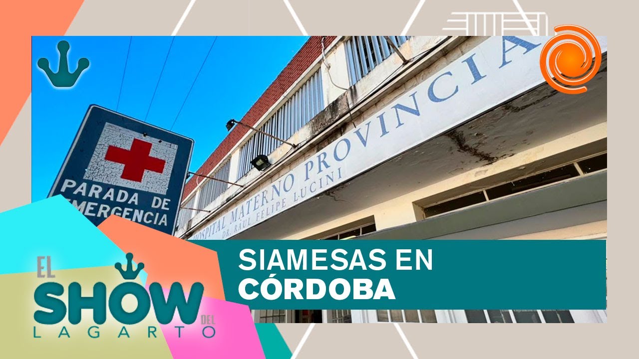 Nacieron siamesas en la Maternidad Provincial de Córdoba, están unidas por el hígado y el intestino