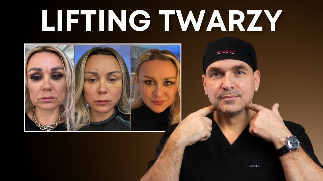 Chirurg plastyczny: wszystko co musisz wiedzieć o Liftingu twarzy!