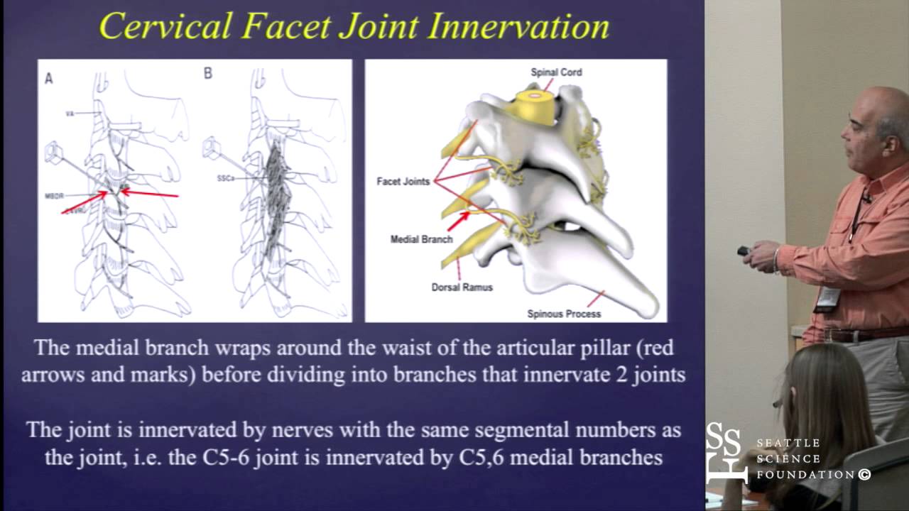 Cervical & Lumbar Facet Joint Anatomy by Mario De Pinto, M.D.