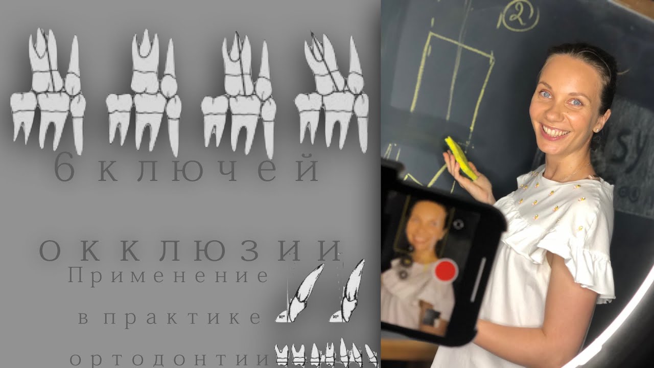 6 ключей окклюзии.Применение в практике. Andrews six keys of occlusion (Russian +English subtitles)