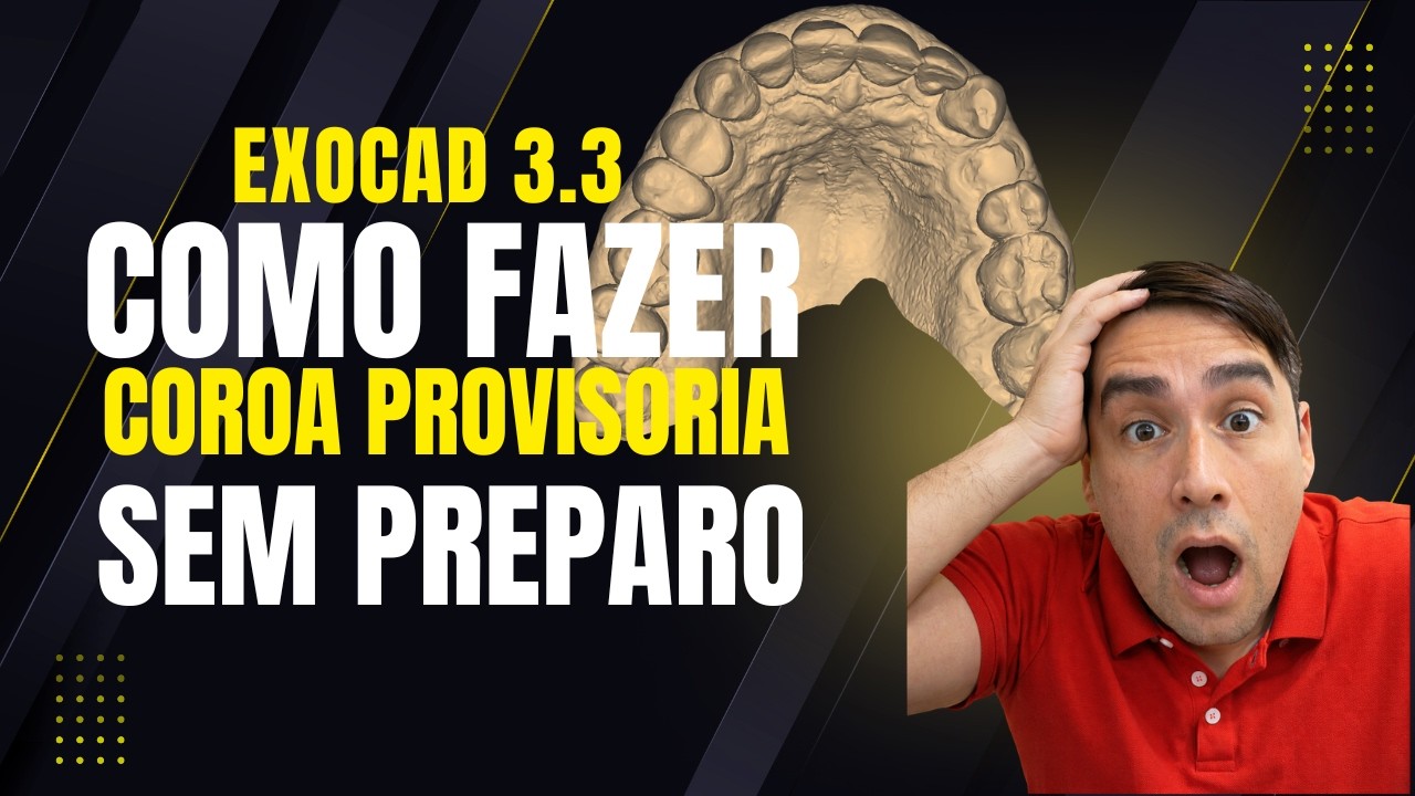 EXOCAd 3.3 - COMO FAZER  COROA PROVISORIA SEM PREPARO