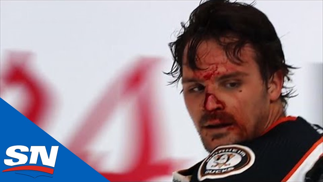 Sam Carrick Left Bloody After Scrap With Jeffrey Viel