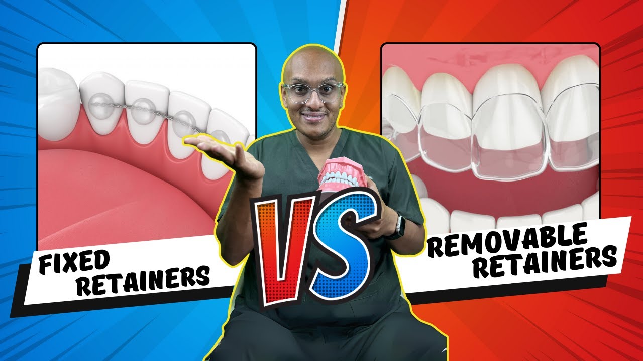 Fixed vs Removable retainer - What&rsquo;s better?