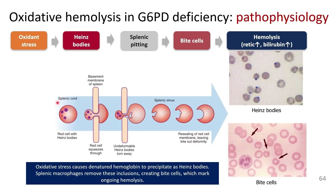 PPT2_anemia_part 8_slides 61-70