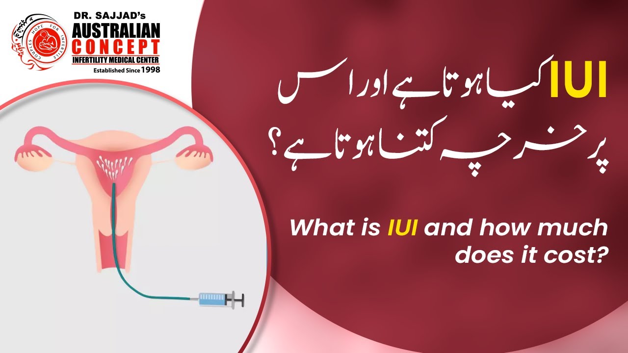IUI Treatment Step by Step | Cost, Success Rate & Who Needs IUI #ivf #iui