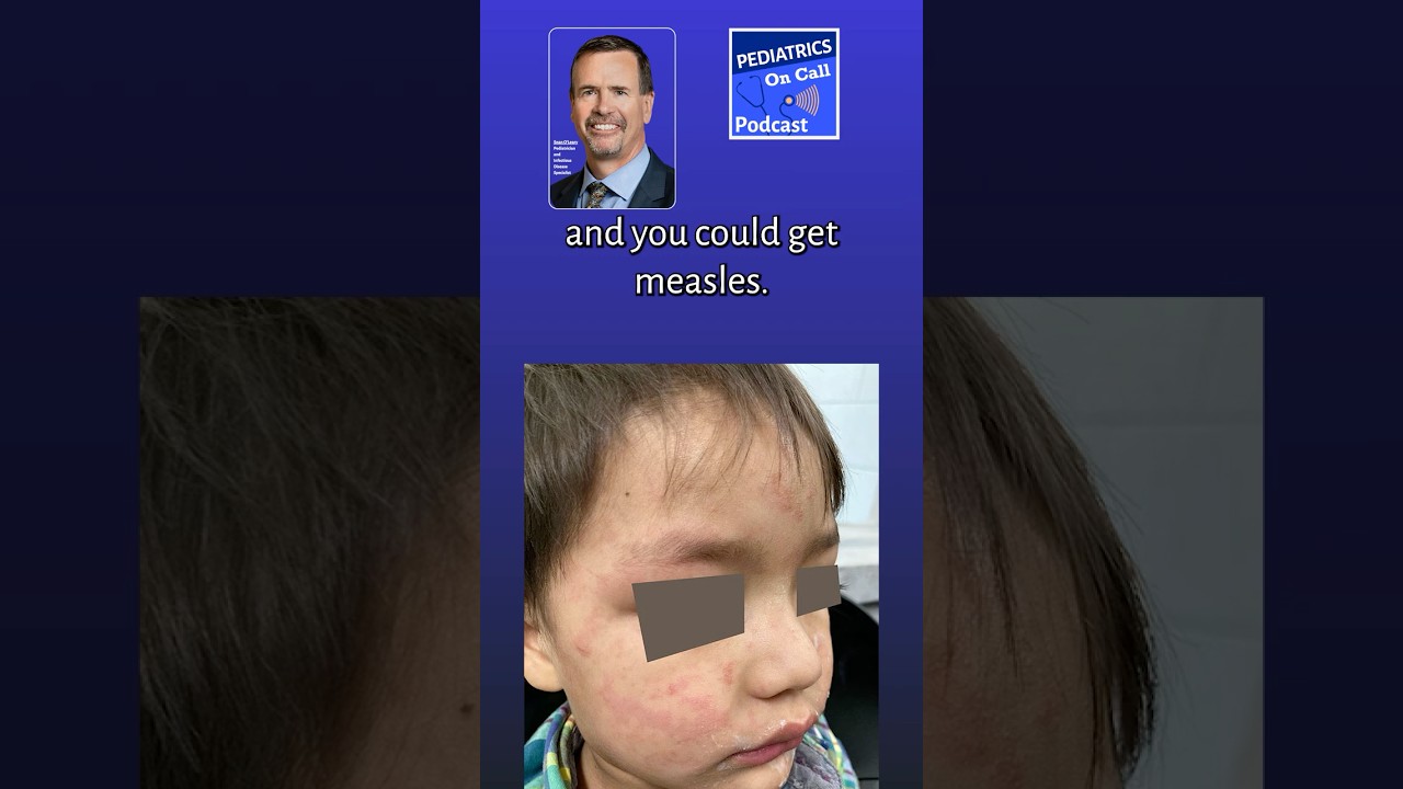 Measles Is The Most Contagious Disease Known to Humankind | AAP