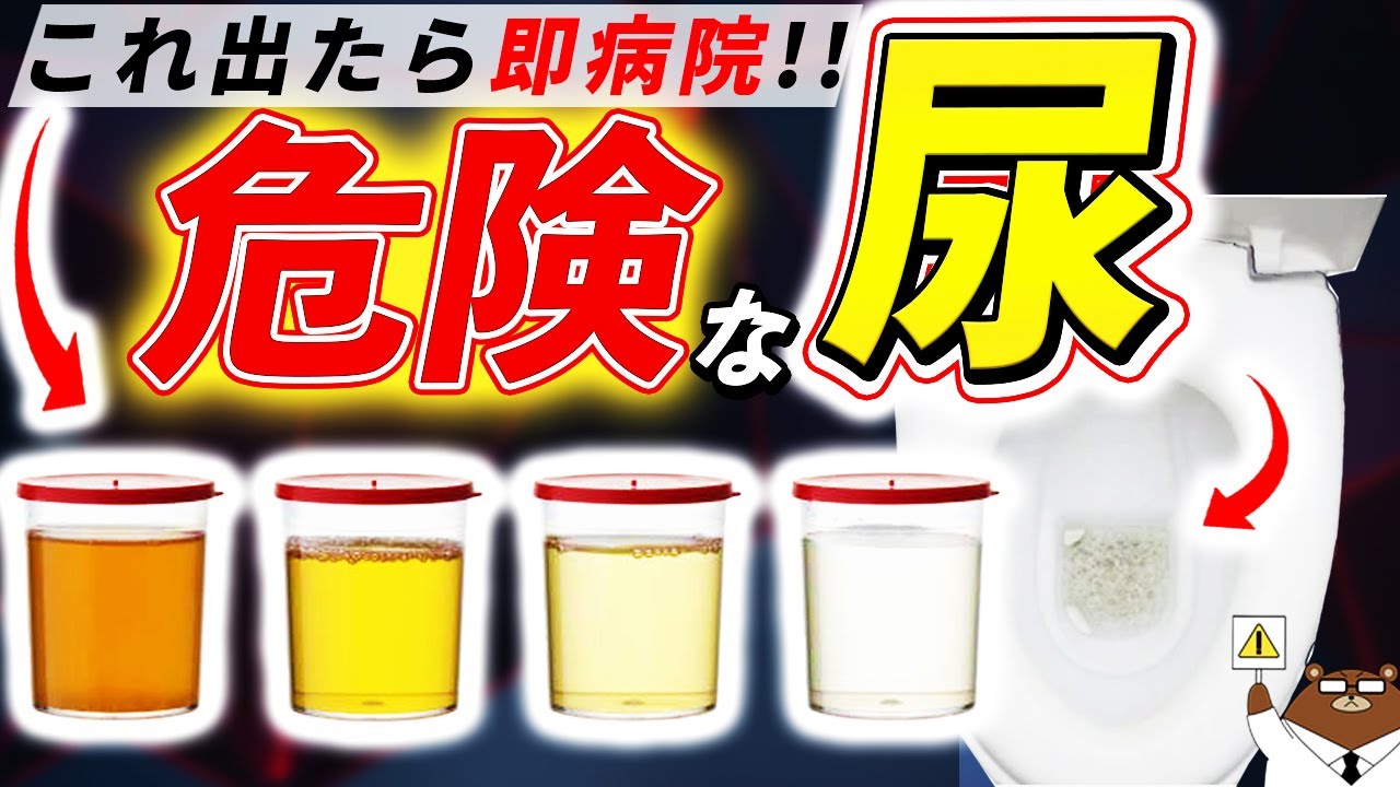 色・臭い・泡立ち・回数..絶対に見逃してはいけない「おしっこ」からのSOS。知らないと後悔する超意外なサインとは？医師が徹底解説！