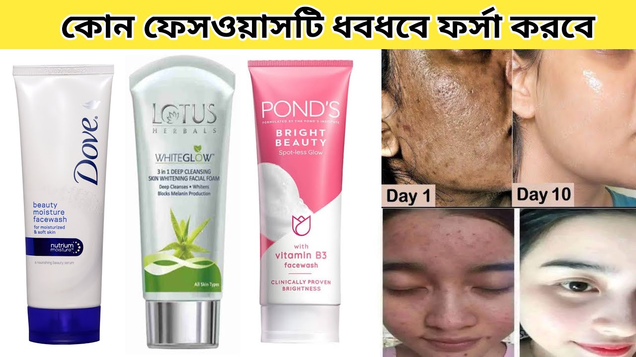 Pond's foaming facewash |Dove moisture facewash|Facewash for oilyskin|Facewash for dry skin|Cleanser
