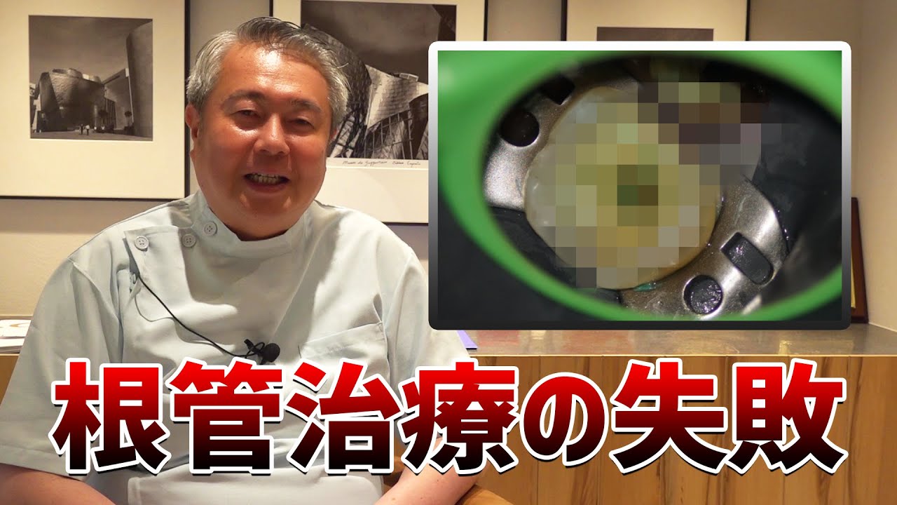 根管治療の失敗！？修復が難しい場合は抜歯しなければいけないのか？【吉松歯科医院｜虎ノ門】