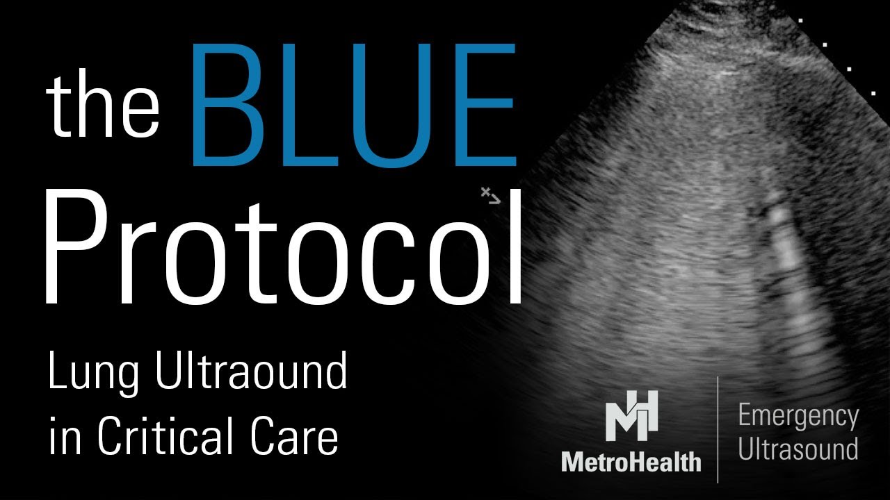 The BLUE Protocol