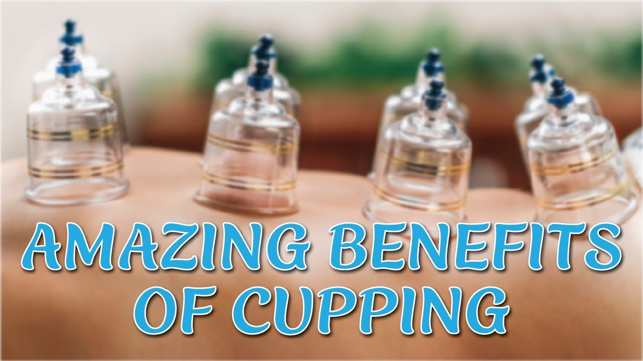 AMAZING Benefits of Cupping Therapy