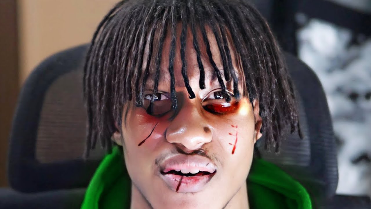 i got beat up...