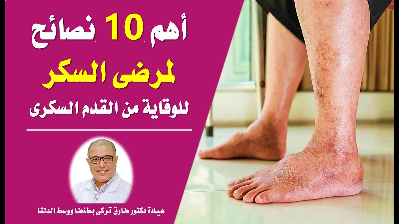 اهم ١٠ نصائح لمرضى السكر للوقايه من القدم السكرى..لن يخبرك بها احد | دكتور طارق تركى