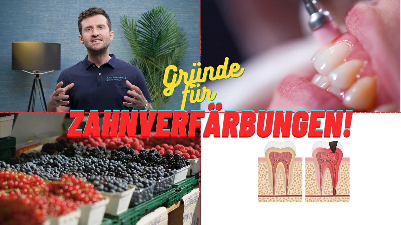 GELBE Z&Auml;HNE? Was Du &uuml;ber Zahnverf&auml;rbungen wissen solltest...
