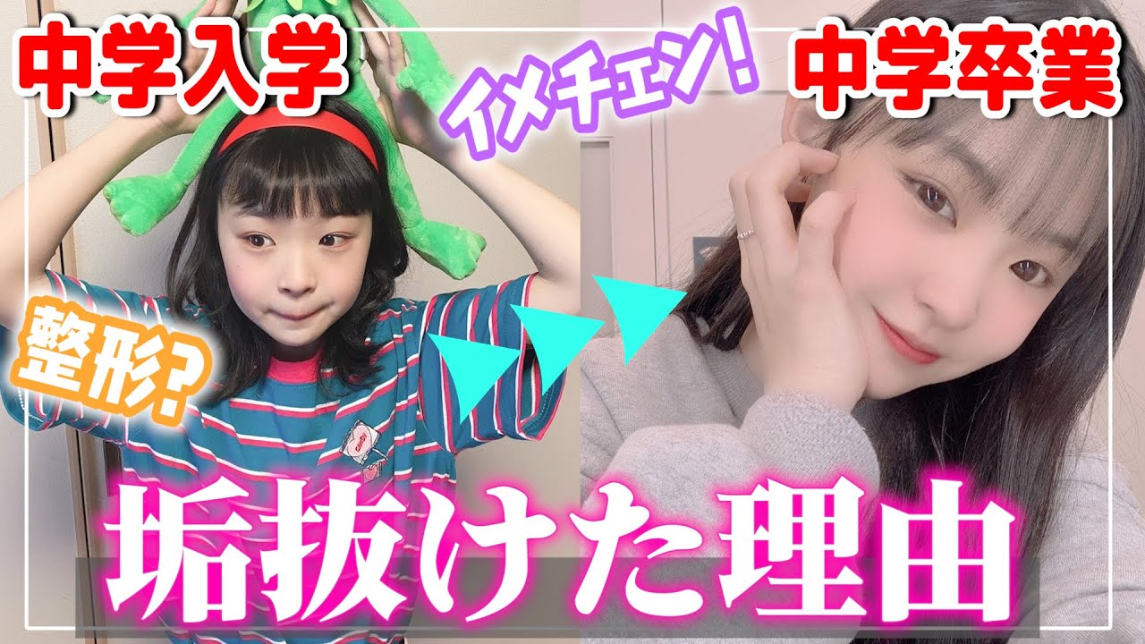 【垢抜け】中学3年間で可愛くなるために努力したこと全て紹介します！