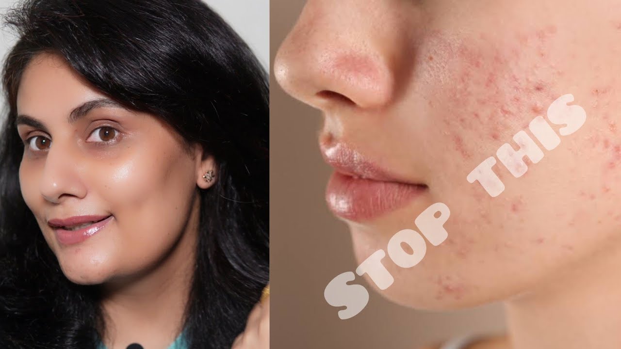 Active ingredients कैसे लगाएं जिससे आपकी स्किन रहे बिलकुल glowy और साफ। Vitamin c, Retinol