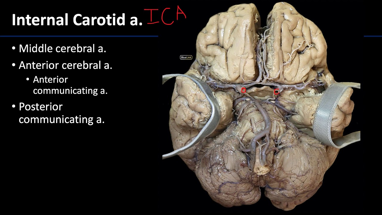 Cranial Cavity and Brain - Arteries